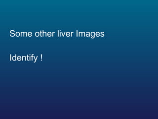 <ul><li>Some other liver Images  </li></ul><ul><li>Identify ! </li></ul>