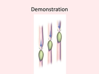  Two layers of smooth muscles: longitudinal & circular muscles What happens in the Oesophagus?Peristalsis-is the Wave like contraction of the walls of the gut to move food down from mouth to stomach