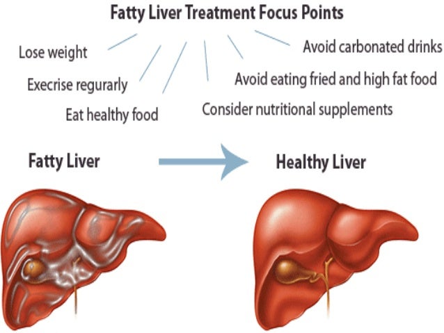 What lifestyle changes can help treat fatty liver disease?