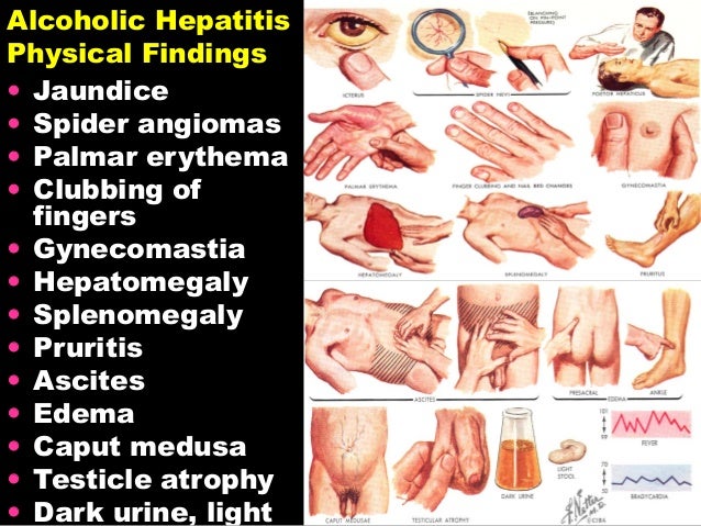 Pathophysiology Of Liver
