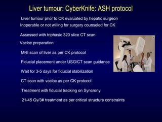 Liver tumour: CyberKnife: ASH protocol
Liver tumour prior to CK evaluated by hepatic surgeon
Inoperable or not willing for surgery counseled for CK
Assessed with triphasic 320 slice CT scan
Vacloc preparation
MRI scan of liver as per CK protocol
Fiducial placement under USG/CT scan guidance
Wait for 3-5 days for fiducial stabilization
CT scan with vacloc as per CK protocol
Treatment with fiducial tracking on Syncrony
21-45 Gy/3# treatment as per critical structure constraints
 