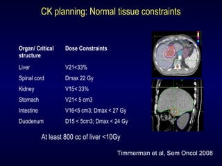 CK planning: Normal tissue constraints
Organ/ Critical
structure
Dose Constraints
Liver V21<33%
Spinal cord Dmax 22 Gy
Kidney V15< 33%
Stomach V21< 5 cm3
Intestine V16<5 cm3; Dmax < 27 Gy
Duodenum D15 < 5cm3; Dmax < 24 Gy
Timmerman et al, Sem Oncol 2008
At least 800 cc of liver <10Gy
 