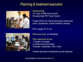 Planning & treatment execution
Contouring:
CT scan & MRI scan fusion
Occasionally PET scan fusion
Target (GTV) & critical structures contoured
(liver, duodenum, small intestine, kidney)
PTV margin ≅ 2 mm
Planning done: on Multiplan
Plan approved as per:
1.Target coverage
2.Critical structure dose
3.Nodes / beamlets / MU / time
Critical structure constraints as per protocol
copyright@www.radiosurgery-india.com
 