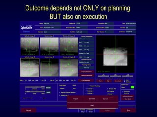 Outcome depends not ONLY on planning
BUT also on execution
 