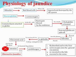 Physiology of jaundice
Obstructive Jaundice
 