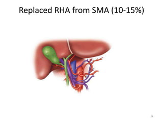 Replaced RHA from SMA (10-15%)
24
 
