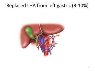 Replaced LHA from left gastric (3-10%)
25
 
