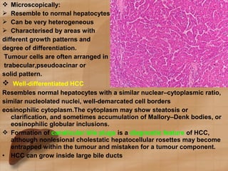 Recent Advances:Hepatocellular Nodules | PPT