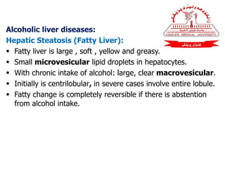 Alcoholic liver diseases:
Hepatic Steatosis (Fatty Liver):
 Fatty liver is large , soft , yellow and greasy.
 Small microvesicular lipid droplets in hepatocytes.
 With chronic intake of alcohol: large, clear macrovesicular.
 Initially is centrilobular, in severe cases involve entire lobule.
 Fatty change is completely reversible if there is abstention
from alcohol intake.
 