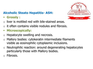 Alcoholic Steato Hepatitis- ASH:
 Grossly :
o liver is mottled red with bile-stained areas.
o it often contains visible nodules and fibrosis.
 Microscopically:
o Hepatocyte swelling and necrosis.
o Mallory bodies: cytokeratin intermediate filaments
visible as eosinophilic cytoplasmic inclusions.
o Neutrophilic reaction: around degenerating hepatocytes
particularly those with Mallory bodies.
o Fibrosis.
 