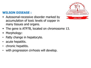 WILSON DISEASE :
 Autosomal-recessive disorder marked by
accumulation of toxic levels of copper in
many tissues and organs.
 The gene is ATP7B, located on chromosome 13.
 Morphology:
• Fatty change in hepatocyte.
• acute hepatitis.
• chronic hepatitis.
• with progression cirrhosis will develop.
 
