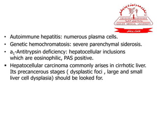 • Autoimmune hepatitis: numerous plasma cells.
• Genetic hemochromatosis: severe parenchymal siderosis.
• a1-Antitrypsin deficiency: hepatocellular inclusions
which are eosinophilic, PAS positive.
 Hepatocellular carcinoma commonly arises in cirrhotic liver.
Its precancerous stages ( dysplastic foci , large and small
liver cell dysplasia) should be looked for.
 