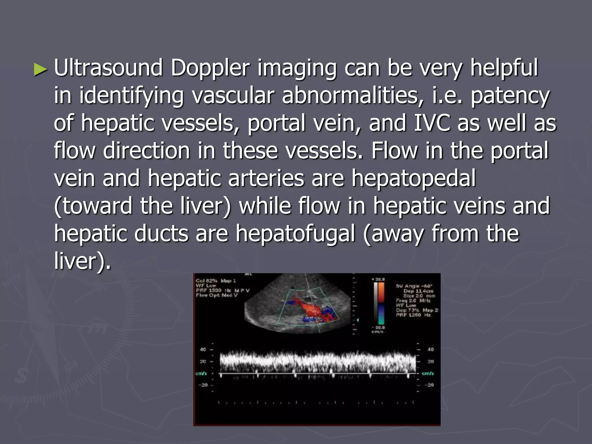 ► Ultrasound Doppler imaging can be very helpful
in identifying vascular abnormalities, i.e. patency
of hepatic vessels, portal vein, and IVC as well as
flow direction in these vessels. Flow in the portal
vein and hepatic arteries are hepatopedal
(toward the liver) while flow in hepatic veins and
hepatic ducts are hepatofugal (away from the
liver).
 