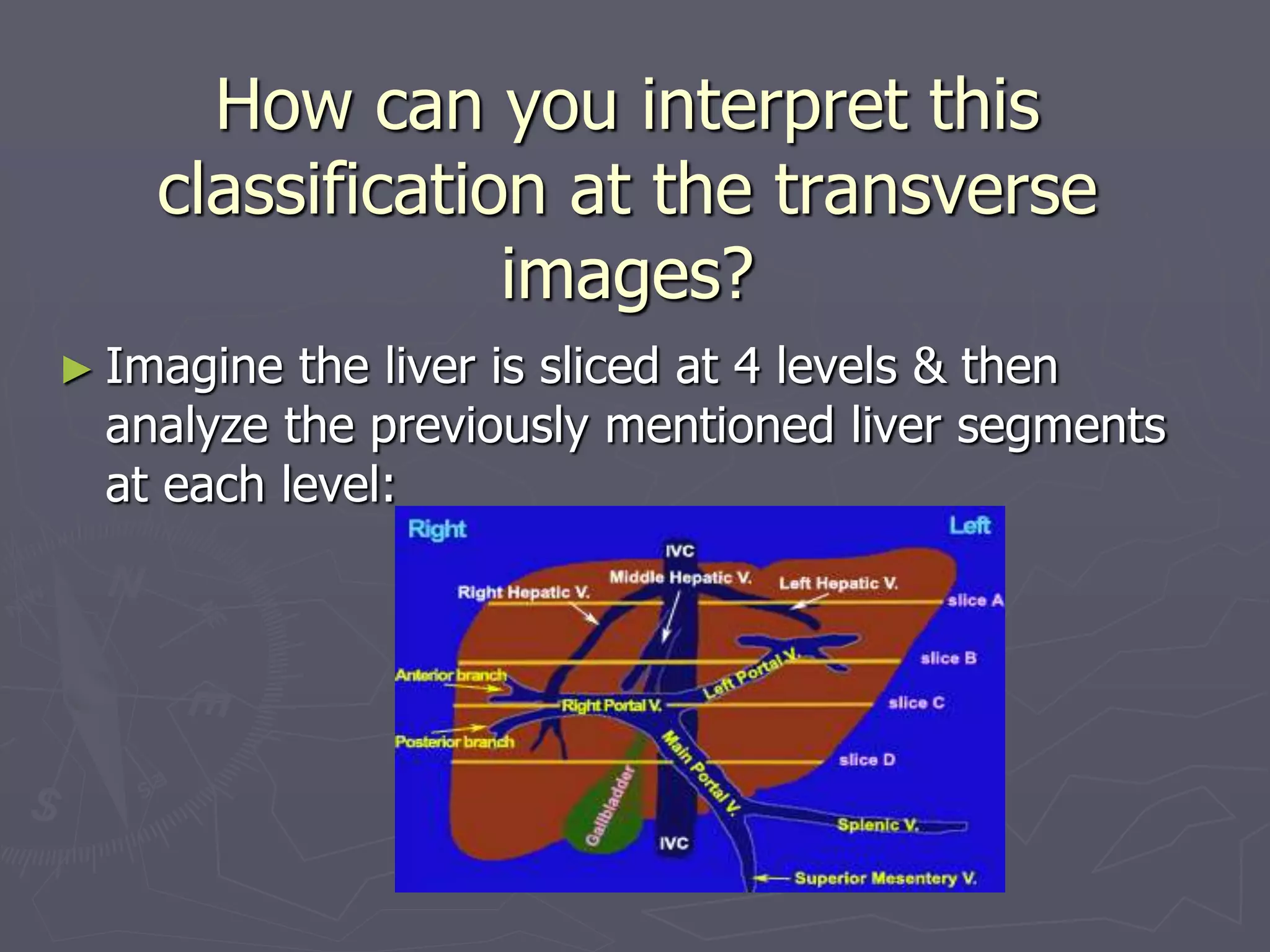 How can you interpret this
classification at the transverse
images?
► Imagine the liver is sliced at 4 levels & then
analyze the previously mentioned liver segments
at each level:
 