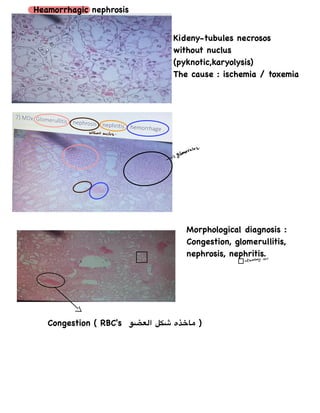 Pknotic Rbc pathology photo | PDF