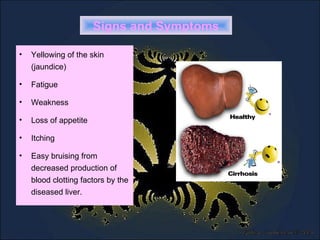 Signs and Symptoms Yellowing of the skin (jaundice)  Fatigue  Weakness  Loss of appetite  Itching  Easy bruising from decreased production of blood clotting factors by the diseased liver. 