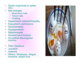 Spider angiomata or spider nevi. Nail changes.  Muehrcke's nails  Terry's nails Clubbing  Hypertrophic osteoarthropathy.  Dupuytren's contracture.  Gynecomastia Hypogonadism Splenomegaly  AscitesCaput medusa Cruveilhier-Baumgarten murmur.  Fetor hepaticus Jaundice Asterixis  Others. Weakness, fatigue, anorexia, weight loss. 