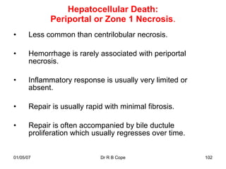Hepatocellular Death:
             Periportal or Zone 1 Necrosis.
•      Less common than centrilobular necrosis.

•      Hemorrhage is rarely associated with periportal
       necrosis.

•      Inflammatory response is usually very limited or
       absent.

•      Repair is usually rapid with minimal fibrosis.

•      Repair is often accompanied by bile ductule
       proliferation which usually regresses over time.


01/05/07                     Dr R B Cope                  102
 