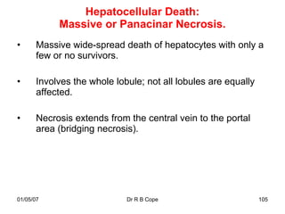 Hepatocellular Death:
           Massive or Panacinar Necrosis.
•     Massive wide-spread death of hepatocytes with only a
      few or no survivors.

•     Involves the whole lobule; not all lobules are equally
      affected.

•     Necrosis extends from the central vein to the portal
      area (bridging necrosis).




01/05/07                    Dr R B Cope                        105
 