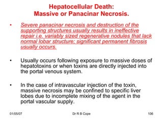 Hepatocellular Death:
            Massive or Panacinar Necrosis.
•      Severe panacinar necrosis and destruction of the
       supporting structures usually results in ineffective
       repair i.e. variably sized regenerative nodules that lack
       normal lobar structure; significant permanent fibrosis
       usually occurs.

•      Usually occurs following exposure to massive doses of
       hepatotoxins or when toxins are directly injected into
       the portal venous system.

•      In the case of intravascular injection of the toxin,
       massive necrosis may be confined to specific liver
       lobes due to incomplete mixing of the agent in the
       portal vascular supply.

01/05/07                     Dr R B Cope                      106
 