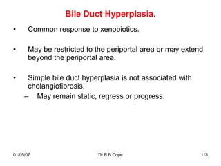 Bile Duct Hyperplasia.
•      Common response to xenobiotics.

•      May be restricted to the periportal area or may extend
       beyond the periportal area.

•     Simple bile duct hyperplasia is not associated with
      cholangiofibrosis.
     – May remain static, regress or progress.




01/05/07                    Dr R B Cope                     113
 