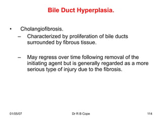 Bile Duct Hyperplasia.

•     Cholangiofibrosis.
     – Characterized by proliferation of bile ducts
        surrounded by fibrous tissue.

     –     May regress over time following removal of the
           initiating agent but is generally regarded as a more
           serious type of injury due to the fibrosis.




01/05/07                      Dr R B Cope                     114
 