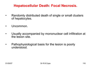 Hepatocellular Death: Focal Necrosis.

•     Randomly distributed death of single or small clusters
      of hepatocytes.

•     Uncommon.

•     Usually accompanied by mononuclear cell infiltration at
      the lesion site.

•     Pathophysiological basis for the lesion is poorly
      understood.




01/05/07                    Dr R B Cope                    116
 