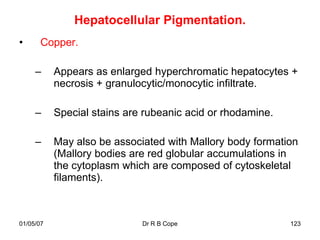 Hepatocellular Pigmentation.
•     Copper.

     –     Appears as enlarged hyperchromatic hepatocytes +
           necrosis + granulocytic/monocytic infiltrate.

     –     Special stains are rubeanic acid or rhodamine.

     –     May also be associated with Mallory body formation
           (Mallory bodies are red globular accumulations in
           the cytoplasm which are composed of cytoskeletal
           filaments).



01/05/07                     Dr R B Cope                    123
 