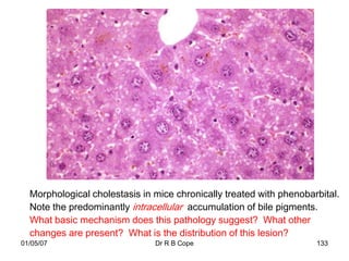 Morphological cholestasis in mice chronically treated with phenobarbital.
  Note the predominantly intracellular accumulation of bile pigments.
  What basic mechanism does this pathology suggest? What other
  changes are present? What is the distribution of this lesion?
01/05/07                       Dr R B Cope                           133
 