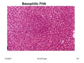 Basophilic FHA




01/05/07           Dr R B Cope   147
 
