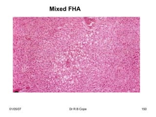 Mixed FHA




01/05/07        Dr R B Cope   150
 