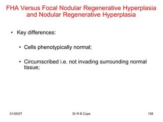 FHA Versus Focal Nodular Regenerative Hyperplasia
      and Nodular Regenerative Hyperplasia

 • Key differences:

      • Cells phenotypically normal;

      • Circumscribed i.e. not invading surrounding normal
        tissue;




 01/05/07                   Dr R B Cope                      158
 