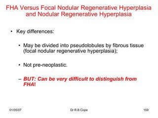 FHA Versus Focal Nodular Regenerative Hyperplasia
      and Nodular Regenerative Hyperplasia

 • Key differences:

      • May be divided into pseudolobules by fibrous tissue
        (focal nodular regenerative hyperplasia);

      • Not pre-neoplastic.

      – BUT: Can be very difficult to distinguish from
        FHA!



 01/05/07                     Dr R B Cope                 159
 