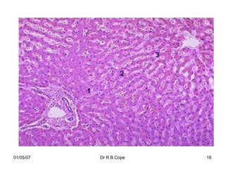 01/05/07   Dr R B Cope   16
 