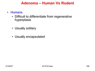 Adenoma – Human Vs Rodent

 • Humans
    • Difficult to differentiate from regenerative
      hyperplasia

      • Usually solitary

      • Usually encapsulated




01/05/07                   Dr R B Cope               166
 