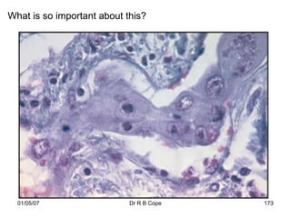 What is so important about this?




  01/05/07                  Dr R B Cope   173
 