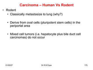 Carcinoma – Human Vs Rodent
• Rodent
   • Classically metastasize to lung (why?)

   • Derive from oval cells (pluripotent stem cells) in the
     periportal area

   • Mixed cell tumors (i.e. hepatocyte plus bile duct cell
     carcinomas) do not occur




  01/05/07                   Dr R B Cope                      175
 