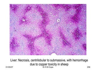 Liver: Necrosis, centrilobular to submassive, with hemorrhage
                     due to copper toxicity in sheep
01/05/07                      Dr R B Cope                        256
 