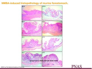 NMBA-induced histopathology of murine forestomach.




                                            Zanesi N et al. PNAS 2001;98:10250-10255



©2001 by The National Academy of Sciences
 