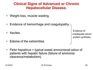 Clinical Signs of Advanced or Chronic
                   Hepatocellular Disease.

• Weight loss, muscle wasting.

• Evidence of hemorrhage and coagulopathy.

                                              Evidence of
• Ascites.                                    inadequate serum
                                              protein synthesis.
• Edema of the extremities.

• Fetor hepaticus = typical sweet ammoniacal odour of
  patients with hepatic failure (failure of ammonia
  clearance/metabolism).

01/05/07                  Dr R B Cope                     58
 