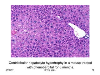 Centrilobular hepatocyte hypertrophy in a mouse treated
              with phenobarbital for 8 months.
01/05/07                 Dr R B Cope                    78
 