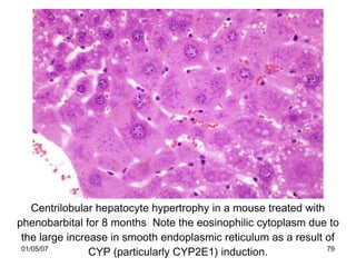 Centrilobular hepatocyte hypertrophy in a mouse treated with
phenobarbital for 8 months Note the eosinophilic cytoplasm due to
 the large increase in smooth endoplasmic reticulum as a result of
 01/05/07
                CYP (particularly CYP2E1) induction.             79
 