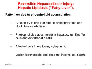 Reversible Hepatocellular Injury:
             Hepatic Lipidosis (“Fatty Liver”).
Fatty liver due to phospholipid accumulation.

     –     Caused by toxins that bind to phosopholipids and
           block their catabolism.

     –     Phosopholipids accumulate in hepatocytes, Kupffer
           cells and extrahepatic cells.

     –     Affected cells have foamy cytoplasm.

     –     Lesion is reversible and does not involve cell death.

01/05/07                      Dr R B Cope                      92
 