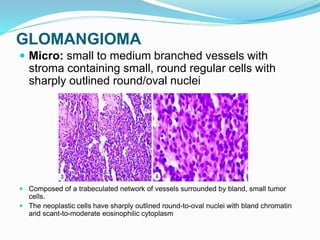 GLOMANGIOMA
 Micro: small to medium branched vessels with
stroma containing small, round regular cells with
sharply outlined round/oval nuclei
 Composed of a trabeculated network of vessels surrounded by bland, small tumor
cells.
 The neoplastic cells have sharply outlined round-to-oval nuclei with bland chromatin
and scant-to-moderate eosinophilic cytoplasm
 