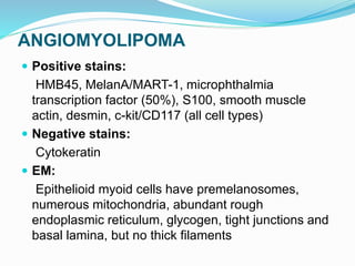 ANGIOMYOLIPOMA
 Positive stains:
HMB45, MelanA/MART-1, microphthalmia
transcription factor (50%), S100, smooth muscle
actin, desmin, c-kit/CD117 (all cell types)
 Negative stains:
Cytokeratin
 EM:
Epithelioid myoid cells have premelanosomes,
numerous mitochondria, abundant rough
endoplasmic reticulum, glycogen, tight junctions and
basal lamina, but no thick filaments
 