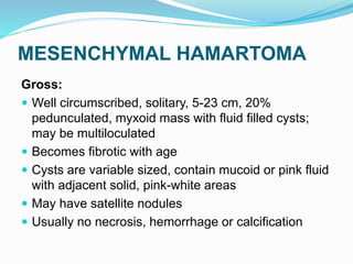 MESENCHYMAL HAMARTOMA
Gross:
 Well circumscribed, solitary, 5-23 cm, 20%
pedunculated, myxoid mass with fluid filled cysts;
may be multiloculated
 Becomes fibrotic with age
 Cysts are variable sized, contain mucoid or pink fluid
with adjacent solid, pink-white areas
 May have satellite nodules
 Usually no necrosis, hemorrhage or calcification
 