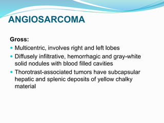 ANGIOSARCOMA
Gross:
 Multicentric, involves right and left lobes
 Diffusely infiltrative, hemorrhagic and gray-white
solid nodules with blood filled cavities
 Thorotrast-associated tumors have subcapsular
hepatic and splenic deposits of yellow chalky
material
 