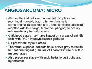 ANGIOSARCOMA: MICRO
 Also epithelioid cells with abundant cytoplasm and
prominent nucleoli, bizarre tumor giant cells,
fibrosarcoma-like spindle cells, cholestatic hepatocellular
rosettes with bile plugs, tumor cell phagocytic activity,
extramedullary hematopoiesis
 Childhood cases may have kaposiform areas of spindle
cells with PAS+ intracytoplasmic globules
 No prominent myxoid areas
 Thorotrast exposed patients have brown-gray refractile
but not birefringent granules of Thorotrast free or within
macrophages
 Also precursor stage with endothelial hypertrophy and
hyperplasia
 