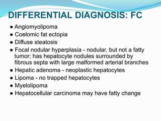 DIFFERENTIAL DIAGNOSIS: FC
● Angiomyolipoma
● Coelomic fat ectopia
● Diffuse steatosis
● Focal nodular hyperplasia - nodular, but not a fatty
tumor; has hepatocyte nodules surrounded by
fibrous septa with large malformed arterial branches
● Hepatic adenoma - neoplastic hepatocytes
● Lipoma - no trapped hepatocytes
● Myelolipoma
● Hepatocellular carcinoma may have fatty change
 