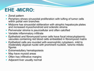 EHE -MICRO:
 Zonal pattern
 Periphery shows sinusoidal proliferation with tufting of tumor cells
within portal vein branches
 Midzone has sinusoidal obliteration with atrophic hepatocyte plates
and increased myxochondroid and sclerotic stroma
 Perivenular stroma is paucicellular and often calcified
 Variable inflammatory infiltrate
 Epithelioid and fibromyxoid tumor cells have focal intracytoplasmic
vacuoles containing red blood cells embedded in fibromyxoid matrix
 Epithelioid cells are rounded with eosinophilic cytoplasm, mild to
moderately atypical nuclei with prominent nucleoli, rare/no mitotic
figures
 Extramedullary hematopoiesis
 May have myxoid areas
 Often has infiltrative margins
 Adjacent liver usually normal
 